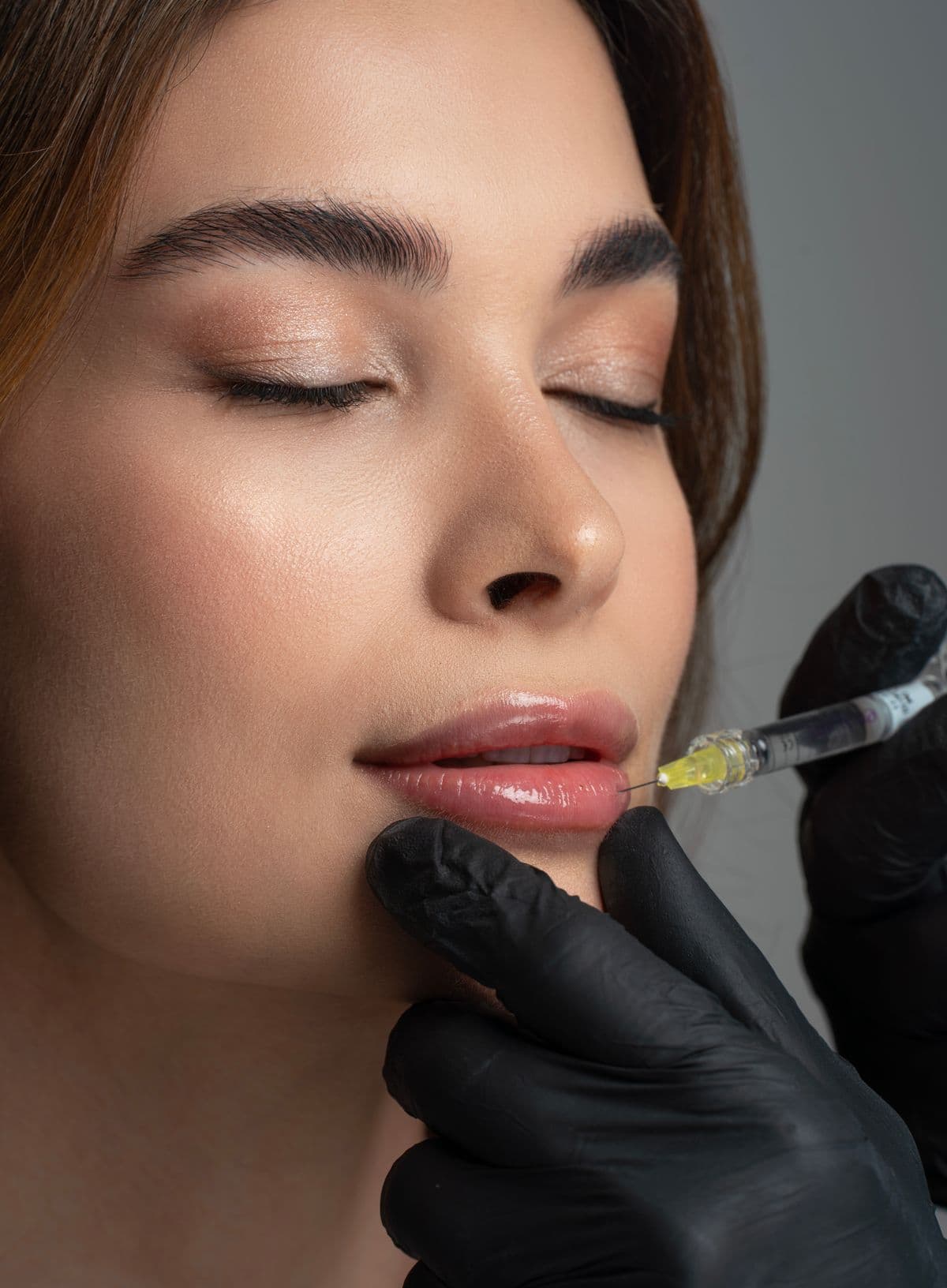 A tasteful dermal filler treatment