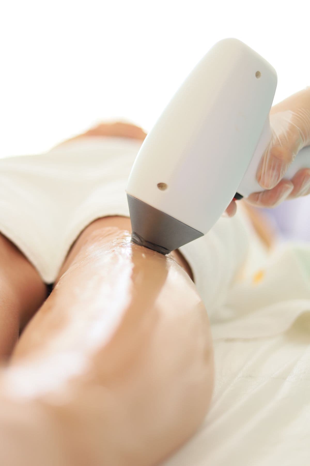 A professional laser hair removal treatment